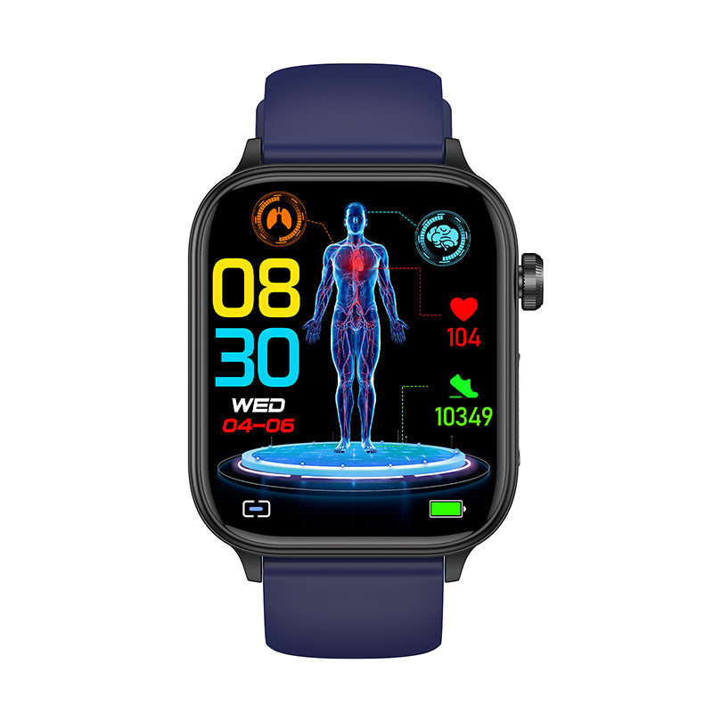 ECG Blood Glucose Intelligent Micro-Physical Examination Stress Monitoring Smartwatch